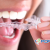 [Imagen:¡Paga Q99 en lugar de Q950 por Guarda-Retenedor para Tratamiento Contra Rechinado de Dientes (Bruxismo), Tratamientos Post-Ortodoncia, Implantes Dentales o Coronas + Evaluación Dental!]