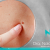 [Imagen:¡Paga $20 en Lugar de $100 por Eliminación de hasta 20 Verrugas o Cabezas de Vena en Cuello, Axilas o Rostro + Consulta Dermatológica!]