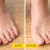[Imagen:¡Paga Q99 en lugar de Q200 por Férula Hallux Valgus para Corrección de Juanetes!]