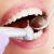 [Imagen:¡Paga Q99 en lugar de Q300 por 1 Relleno Dental de Resina (Sustitución de Amalgama)!]