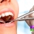 [Imagen:¡Paga Q85 en lugar de Q400 por Limpieza Dental Completa con Eliminación de Sarro y Manchas con Ultrasonido + Pulido Dental con Profijet + Aplicación de Flúor y Examen Diagnóstico con Radiografías Digitales!]