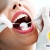 [Imagen:¡Paga $21 en Lugar de $125 por 2 Rellenos de Resina o 3 Sellantes + Limpieza Dental con Ultrasonido + Aplicación de Flúor + Pulido Dental + Consulta y Diagnóstico Bucodental con Cámara Intraoral + Evaluación de Cordales!]