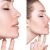 [Imagen:¡Paga Q1,899 en Lugar de Q11,000 por Rinomodelación o Rejuvenecimiento Facial con Hilos Tensores + PRP + Aplicación de Ácido Hialurónico o Plasma Gel + 1 Limpieza Facial Profunda + Microdermoabrasión + Evaluación!]