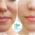 [Imagen:¡Paga Q999 en lugar de Q4,500 por Lifting de Párpados (Superiores o Inferiores) o de Labio Superior (Código de Barras) con Plasma Láser!]