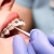 [Imagen:¡Paga Q299 en Lugar de Q950 por Colocación de Brackets Metálicos (Superiores e Inferiores) + Evaluación y Diagnóstico Clínico + Profilaxis Dental + Fotografías Dentales!]