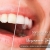 [Imagen:¡Paga Q449 en Lugar de Q3,598 por Blanqueamiento Dental con Luz LED + Limpieza Ultrasónica Profunda con Eliminación de Sarro y de Manchas de Colorantes con Pulido Profiject + Sistema de Detección de Bacterias Dentales!]