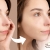 [Imagen:¡Paga Q169 en Lugar de Q900 por Terapia Clínica Anti Acné: Luz Pulsada en 2 Puntos del Rostro + Alta Frecuencia + Exfoliación Suave + Extracción de Impurezas + Mascarilla Combinada Descongestiva y Desinfectante!]