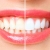 [Imagen:¡Paga $50 en Lugar de $225 por Blanqueamiento Dental Químico con Luz LED + Limpieza Profunda con Ultrasonido (Detartraje) + Consulta Odontológica + Aplicación de Refuerzo y Más!]