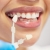 [Imagen:¡Paga $30 en Lugar de $100 por 1 Carilla Dental de Resina Estética que Corrige Imperfecciones y Da un Aspecto Natural + Limpieza con Ultrasonido +  Pulido Dental Profilaxis + Aplicación de Flúor + Diagnóstico Completo +  Evaluación y Más!]
