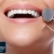 [Imagen:¡Paga $25 en Lugar de $135 por 3 Rellenos o 4 Sellantes + Limpieza con Ultrasonido + Aplicación de Flúor + Diagnóstico con Cámara Intraoral + Evaluación de Ortodoncia!]