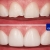 [Imagen:¡Paga $40 en Lugar de $230 por Reconstrucción Estética con Resina de 4 Dientes Frontales + Consulta General + Revisión de Cordales + Limpieza Dental + Aplicación Tópica de Flúor!]