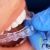 [Imagen:¡Paga $18 en Lugar de $100 por Férula Dental + Limpieza Dental con Ultrasonido + Aplicación Tópica de Flúor + Evaluación!]