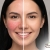 [Imagen:¡Recupera la Confianza en tu Piel! ¡Paga Q195 en Lugar de Q900 por 2 Sesiones de Tratamiento para la Rosácea en Rostro: Evaluación Profesional + Fototerapia LED + Alta Frecuencia + Iontoforesis por Oclusión con Velo de Colágeno + Mascarillas y Más!]
