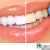 [Imagen:¡Paga Q395 en lugar de Q1,500 por Blanqueamiento Dental Láser + Limpieza y Pulido Dental con Profilaxis + Eliminación de Sarro con Ultrasonido + Aplicación Tópica de Flúor + Examen Diagnóstico en Dental Life!]