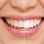 [Imagen:¡Paga Q449 en Lugar de Q3,598 por Blanqueamiento Dental con Luz LED + Limpieza Ultrasónica Profunda con Eliminación de Sarro y de Manchas de Colorantes con Pulido Profiject + Diagnóstico Integral Completo con Radiografías y Fotografías Digitales!]