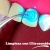 [Imagen:¡Paga Q85 en lugar de Q500 por Limpieza Dental con Ultrasonido + Pulido Dental con Profijet + Aplicación de Flúor + Examen de Diagnóstico con Radiografías Digitales!]