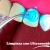 [Imagen:¡Paga $25 en Lugar de $180 por 3 Rellenos de Resina o 4 Sellantes + Radiografía + Limpieza Dental con Ultrasonido + Aplicación de Flúor + Consulta y Diagnóstico Bucodental con Cámara Intraoral + Evaluación de Cordales!]