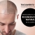 [Imagen:¡Paga $199 en Lugar de $740 por 3 Sesiones de Plasma Rico en Plaquetas para Calvicie o Rejuvenecimiento Facial + 3 Limpiezas de Rostro + 3 Mascarillas de Ozono o Carbón Activado + 3 Microneedling + 6 Mascarillas Vampiro con Colágeno Puro y Más!]