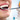 [Imagen:¡Paga $23 en vez de $120 por 2 Rellenos o 3 Sellantes + Limpieza con Ultrasonido + Diagnóstico con Cámara Intraoral + Aplicación de Flúor en Clínica Dental Familiar!]