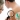 [Imagen:¡Paga Q149 en vez de Q650 por Eliminación Láser de Hasta 5 Lunares, Cabezas de Vena o Arañitas Faciales + Evaluación Profesional en Venas Guatemala!]