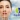 [Imagen:¡Paga Q199 en vez de Q2,800 por Rejuvenecimiento y Relleno Facial para Eliminar Arrugas, Líneas de Expresión y Cicatrices que incluye: Rellenos con Células Madre, Aplicación de Enzimas Plaquetarias, Estiramiento y Tensado Facial y Más en Equilibra!]