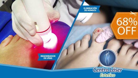 [Imagen:¡Paga $35 en lugar de $110 por 1 Sesión Láser para Eliminar Hongos en 2 Uñas!]
