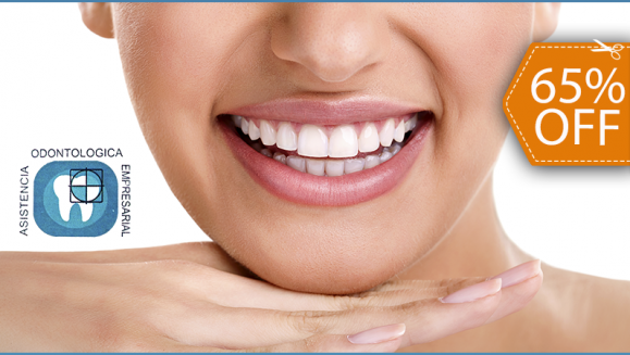 [Imagen:¡Paga $79 en Lugar de $225 por Blanqueamiento Dental con Lámpara LED + Limpieza con Ultrasonido + Profilaxis (Pulido Dental) + Aplicación de Flúor!]