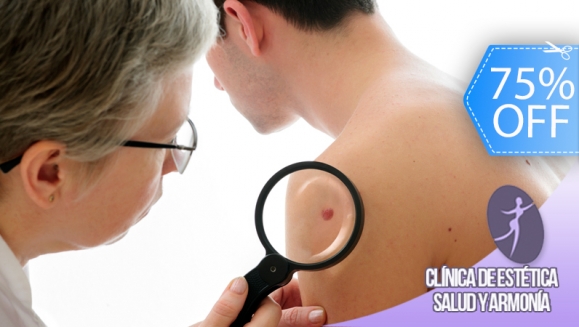 [Imagen:¡Paga Q69 en lugar de Q280 por Cauterización Láser de Mezquinos, Verrugas, Lunares o Cabezas de Vena!]