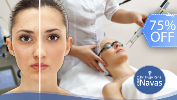 [Imagen:¡Paga Q499 en lugar de Q2,000 por Rejuvenecimiento Láser con CO2 Fraccionado para Reducción de Arrugas, Líneas de Expresión, Manchas y Cicatrices en Área a Elección: Rostro, Cuello o Manos + Consulta de Seguimiento!]