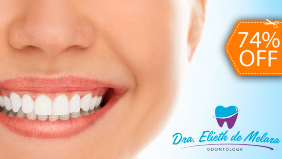 [Imagen:¡Paga $69 en Lugar de $265 por Blanqueamiento Dental con Lámpara UV + Limpieza con Ultrasonido + Aplicación de Gel Desensibilizante!]