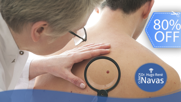 [Imagen:¡Paga Q99 en lugar de Q500 por Sesión Láser Co2 para Eliminar Hasta 10 Cabecitas de Venas y Lunares!]