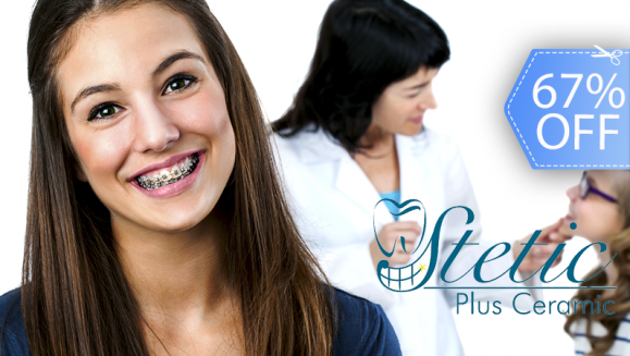 [Imagen:¡Paga Q599 en lugar de Q1,800 por Colocación de Mini-Brackets (Superiores e Inferiores) + Evaluación y Diagnóstico Clínico + Profilaxis Dental + Fotografías y Modelo de Estudio!]