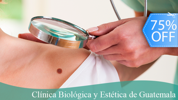 [Imagen:¡Paga Q99 en lugar de Q400 por Cauterización Láser para Eliminar Hasta 10 Cabecitas de Venas, Lunares o Verrugas + Evaluación!]