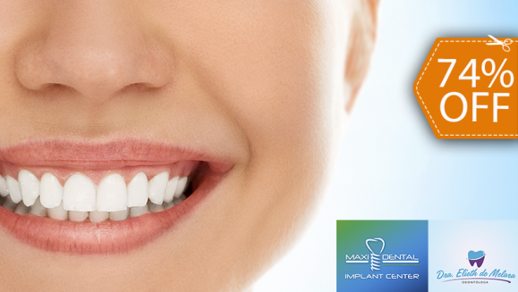 [Imagen:¡Paga $69 en Lugar de $265 por Blanqueamiento Dental con Lámpara UV + Limpieza con Ultrasonido + Aplicación de Gel Desensibilizante!]