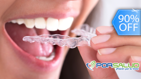 [Imagen:¡Paga Q99 en lugar de Q950 por Guarda-Retenedor para Tratamiento Contra Rechinado de Dientes (Bruxismo), Tratamientos Post-Ortodoncia, Implantes Dentales o Coronas + Evaluación Dental!]