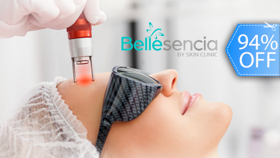[Imagen:¡Paga Q135 en lugar de Q2,100 por Facial Antiacné, Despigmentante o Antiaging que Incluye: Limpieza Profunda + Extracción de Impurezas + 2 Sesiones Láser o 2 Peelings + 2 Mascarillas + 2 Hidrataciones + Protección Solar!]