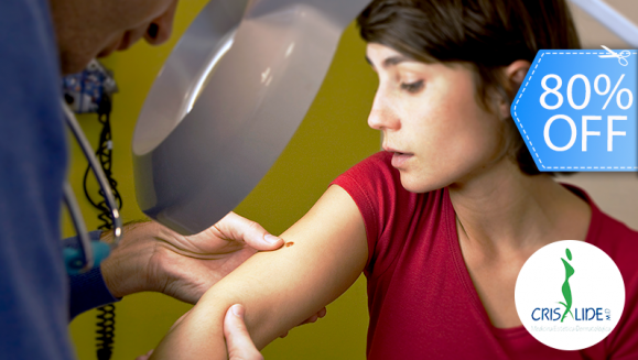 [Imagen:¡Paga Q99 en lugar de Q500 por Cauterización Láser de Mezquinos, Verrugas, Lunares o Cabezas de Vena!]