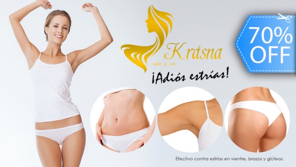[Imagen:¡Paga Q149 en lugar de Q500 por Tratamiento para Estrías en Área a Elección entre Vientre, Glúteos o Brazos que Incluye: 3 Peelings + 3 Láser + 3 Microdermoabrasiones + 3 Radiofrecuencias + 4 Mascarillas de Alto Impacto!]
