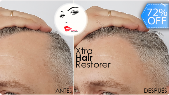 [Imagen:¡Paga Q199 en lugar de Q700 por Tratamiento Anticalvicie que Incluye: 2 Sesiones de Mesoterapia Xtra Hair Restorer + 2 Altafrecuencias + 2 Luces de Fotón + 2 Estimuladores de Ozono!]