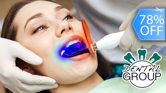 [Imagen:¡Paga Q395 en lugar de Q1,800 por Blanqueamiento Dental con Luz LED + Limpieza Profunda con Ultrasonido + Pulido Dental con Profijet + Aplicación Tópica de Flúor + Evaluación con Cámara Intraoral + Diagnóstico!]