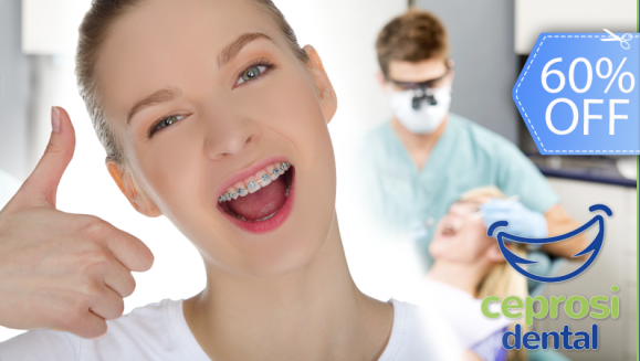 [Imagen:¡Paga Q599 en Lugar de Q1,500 por Colocación de Mini-Brackets Metálicos (Inferior y Superior) + Set de Radiografías Intraorales + Modelos de Estudio + Limpieza Dental + Kit de Limpieza!]