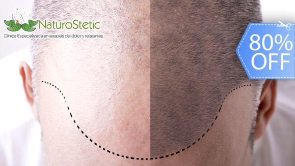 [Imagen:¡Recupera tu Hermosa Cabellera! ¡Paga Q299 en lugar de Q1,500 por 1 Sesión de Plasma Rico en Plaquetas + Terapia de Luz LED para Alopecia (Calvicie)!]