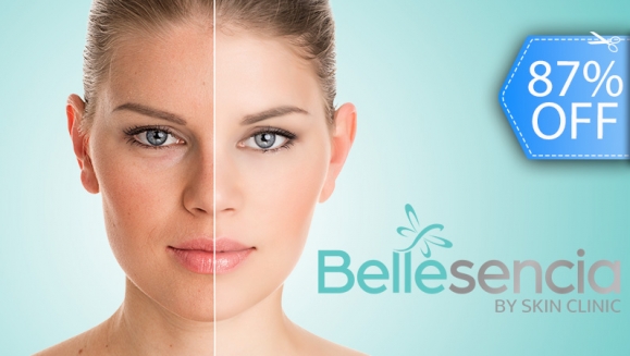 [Imagen:¡Paga Q199 en lugar de Q1,500 por 2 Sesiones de Facial Antiaging que Incluyen: 2 Aplicaciones de Láser IPL + 2 Limpiezas Personalizadas con Producto Orgánico + 2 Mascarilla de Colágeno + 2 Mascarillas Calmantes!]