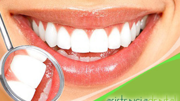 [Imagen:¡Paga Q85 en lugar de Q400 por una limpieza bucal completa que incluye: pulido y desmanchado de dientes + eliminación de sarro + una radiografía intraoral + examen bucal por video imágenes + aplicación de flúor + informe dental en Asistencia Dental!]