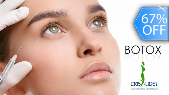 [Imagen:¡Paga Q599 en lugar de Q1,800 y Rejuvenece Tu Rostro con Aplicación de 20 Unidades de Botox en Área a Elección: Frente, Patas de Gallo, Código de Barras (Labio Superior) o Entrecejo + Evaluación Médica!]