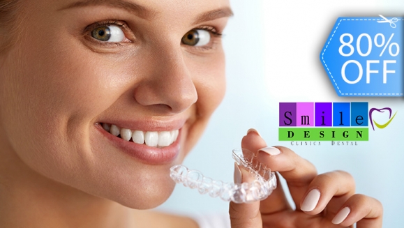 Image of 1 Guarda o 1 Retenedor Dental para Tratamiento de Bruxismo u Ortodoncia