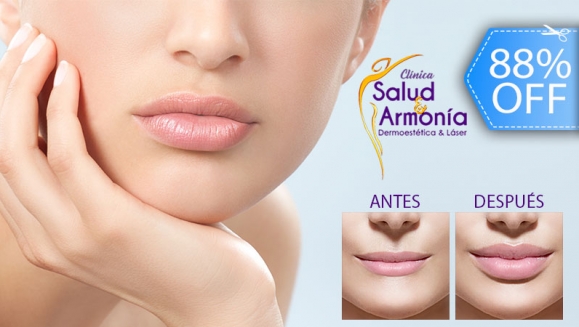 [Imagen:¡Paga Q449 en lugar de Q3,850 por Relleno de Plasma Gel para Aumentar La Hidratación y El Volumen de Los Labios (o Eliminar Arrugas del Entrecejo o Surcos Faciales) + Mascarilla Hidratante + Exfoliación!]