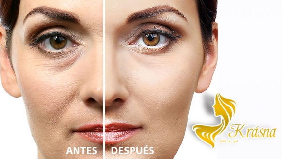 [Imagen:¡Paga Q99 en vez de Q750 por Novedoso Facial de Rejuvenecimiento “Hollywood Peel” con: Radiofrecuencia Tripolar + Aplicación de Láser + Mascarilla de Carbón Activado y Caviar Negro + Extracción de Puntos + Exfoliación + Velo de Colágeno y Más!]