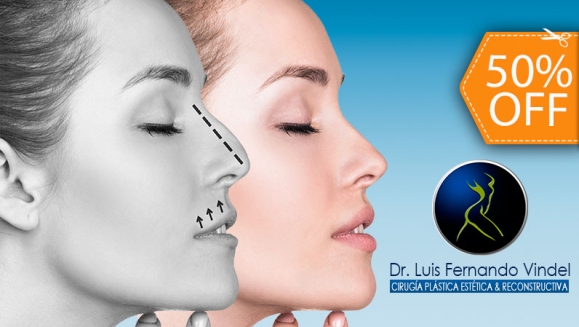 [Imagen:¡Paga $299 en Lugar de $600 por Rinomodelación o Relleno de Labios: Corrige La Punta de la Nariz, Refina o Levanta el Perfil, Reduce el Desnivel o Aumenta el Volumen de Los Labios con La Aplicación de Ácido Hialurónico!]