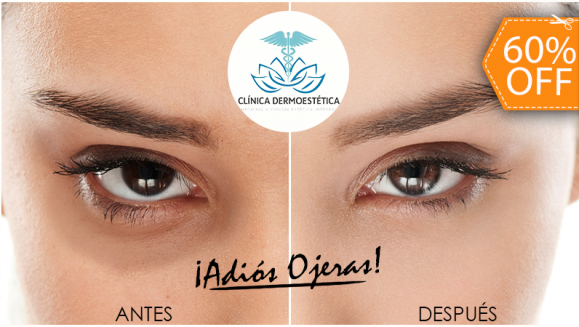 [Imagen:¡Paga $10 en Lugar de $25 por 1 Sesión de Tratamiento Antiojeras que Incluye: Microdermoabrasión + Peeling + Consulta Médica + Evaluación del Cutis con Tecnología Skyn Analyzer!]